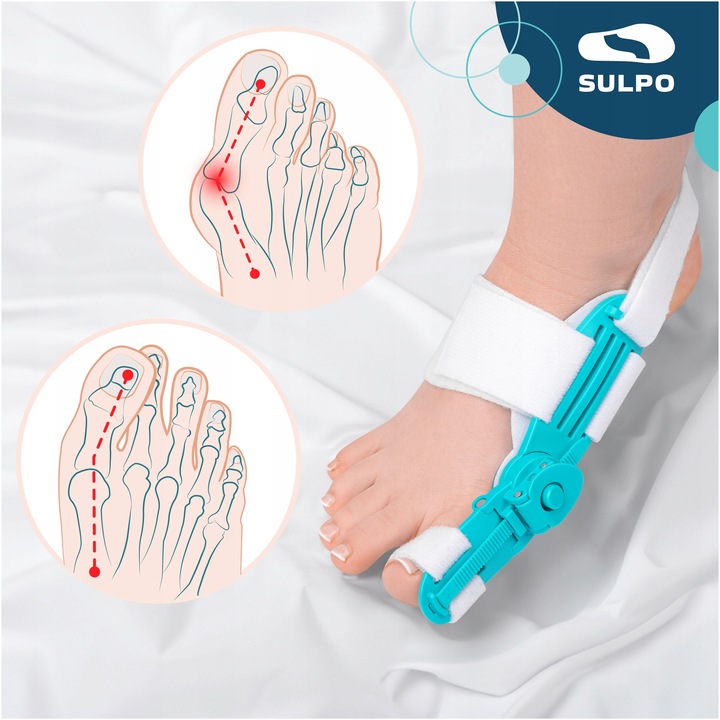 Aparat korygujący ułożenie dużego palca korektor na haluksy dzień i noc