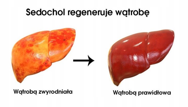 Nowochol na wątrobe nerki dla gołębi Elita 1000ml